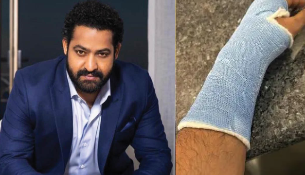 NTR’s Injury is Real PR Team Gave Clarity-Tel